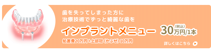 歯を失ってしまった方に　治療技術でずっと綺麗な歯を　インプラントメニュー 30万円（税込）