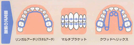 orthodontic_image1